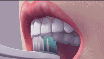 牙龈肿痛出血真的是上火吗,牙齿上火牙龈红肿怎么治疗