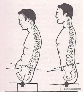 练瑜伽纠正骨盆前倾后腰椎受伤,练瑜伽前屈老是弓背怎么办