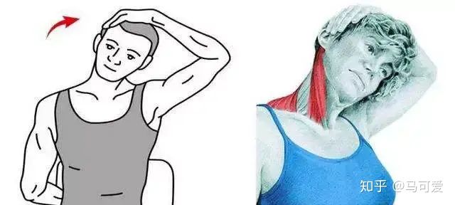 lisa的肩膀是直角肩吗,lisa的直角肩给她带来什么病