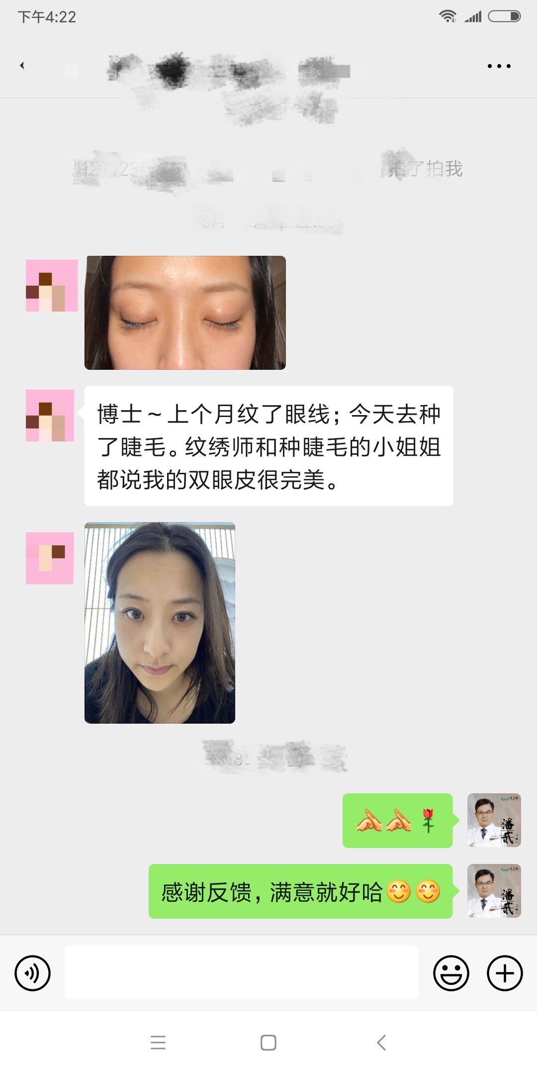 双眼皮失败的女孩,双眼皮失败做成了三眼皮好修复吗