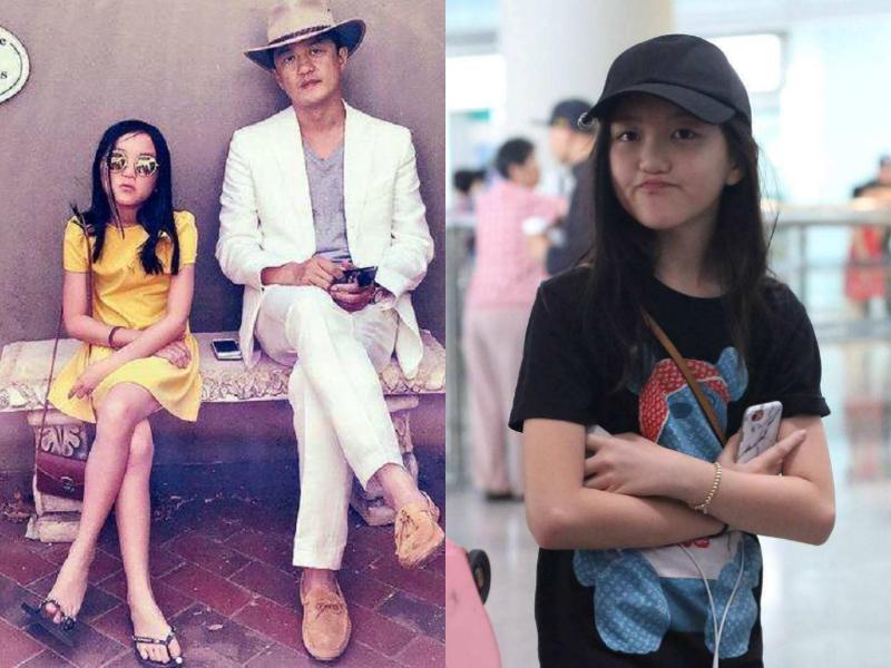 李嫣手术前后,李嫣再次手术兔唇吗