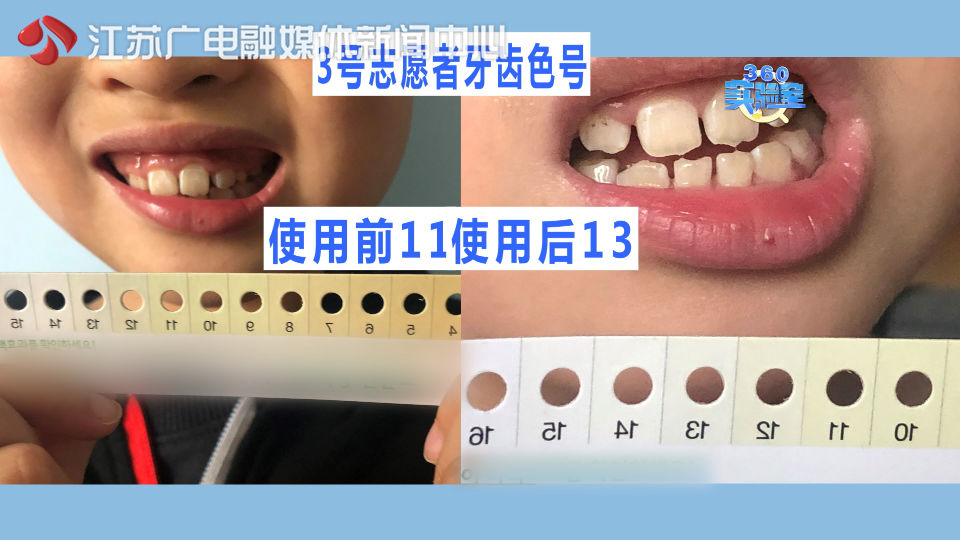 七天实测！“网红”牙贴、牙素、美白笔，真有这么神奇吗？