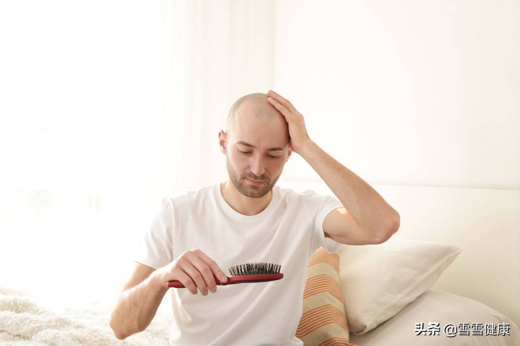 如何治疗脱发和头屑,起头屑脱发怎么办