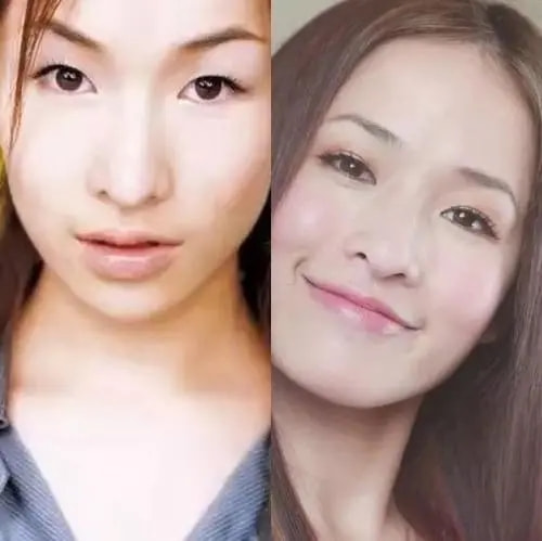 五种双眼皮明星,明星单眼皮张雨绮