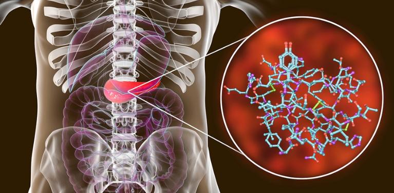 胰岛素与增肌绝对干货 (胰岛素水平低如何增肌)