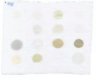 二宝手足口怎么预防大宝不传染,幼儿园手足口预防措施有哪些