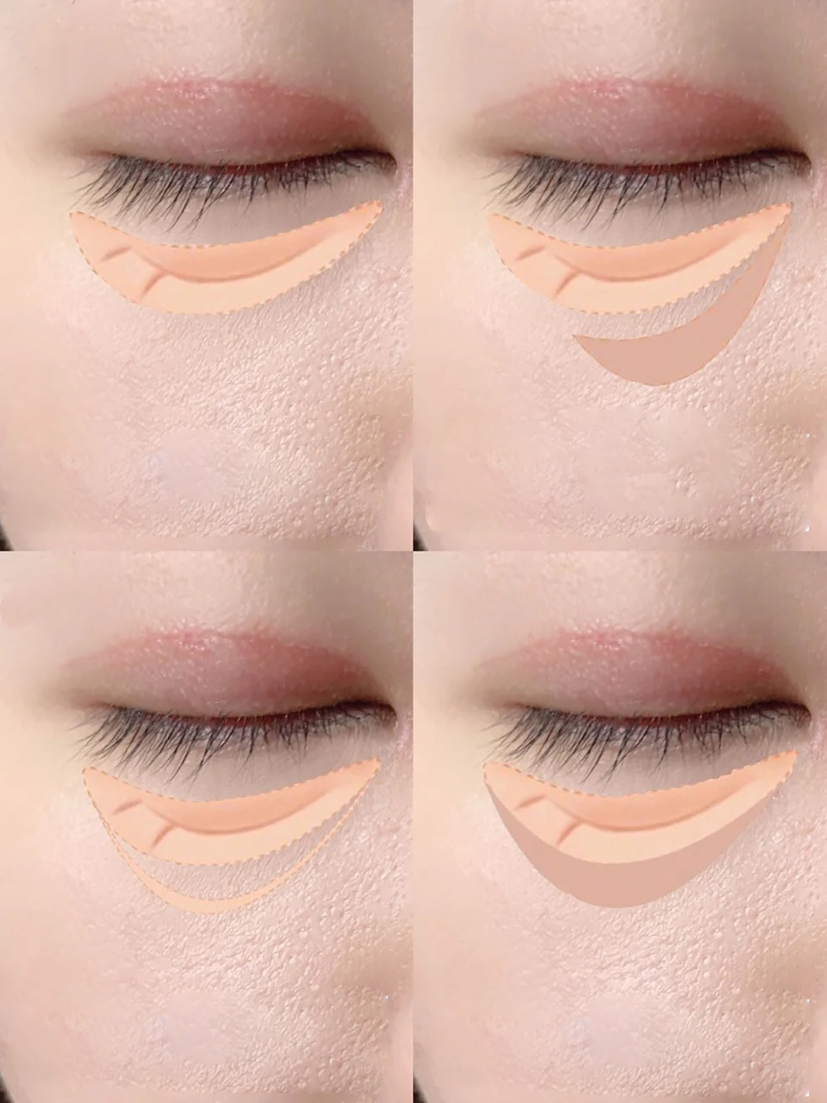 5分钟带你了解眼部问题，面对眼纹不惊慌，快来抄作业