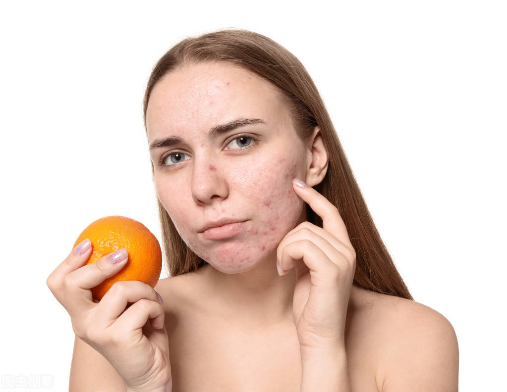 痘痘很严重可以涂什么乳,痘痘严重喝中药有效吗