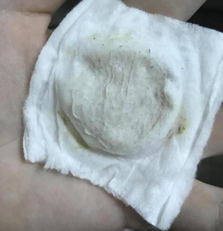 王鸥谈打了瘦脸针,王鸥打过瘦脸针吗