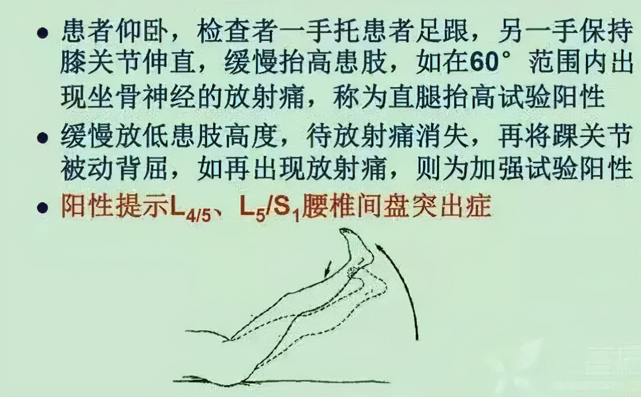 股骨头坏死和腰间盘突出症状区别,椎间盘突出和股骨头坏死症状区别