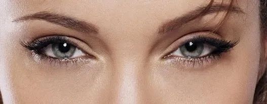 双眼皮形态分类,割双眼皮形态