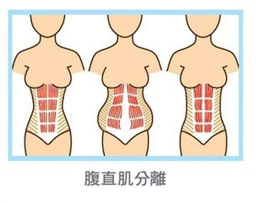 产后一年136斤,产后一星期体重