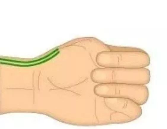 手部工作劳累麻疼怎么办,鼠标手手指发麻如何治疗