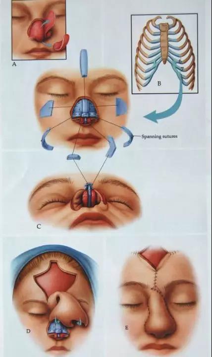 西安医学院一附院,西安医学院一附院整形美容科