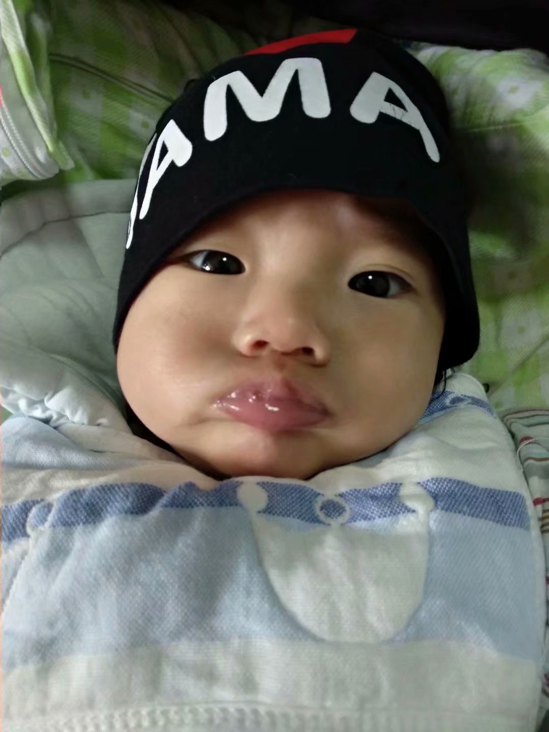 宝宝老是咬下嘴唇有什么方法不咬,2岁宝宝咬下嘴唇怎么改正