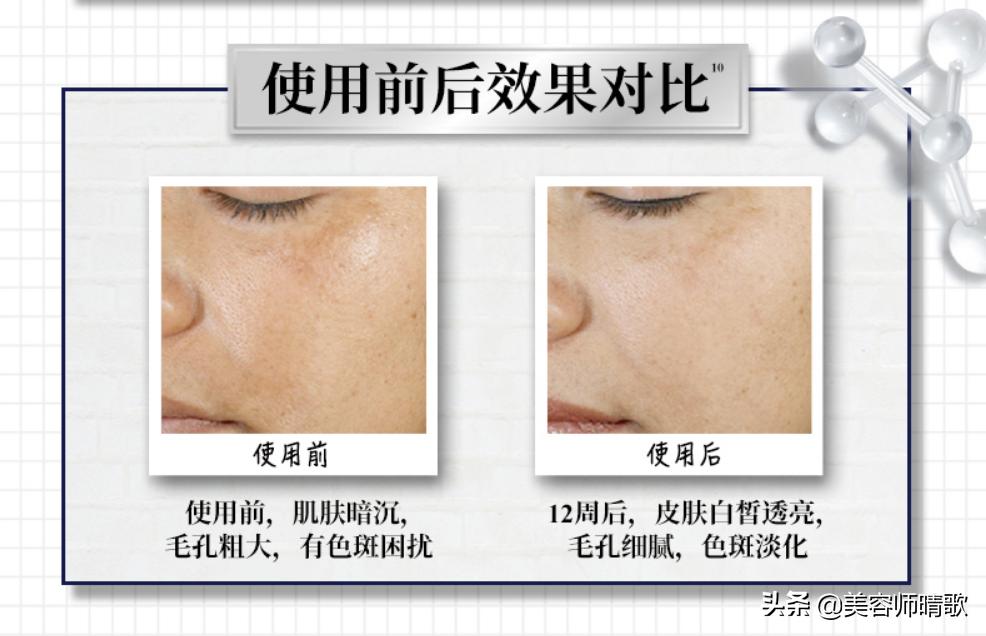 淡斑小白瓶精华100ml,小白瓶淡斑精华适合40岁的用吗