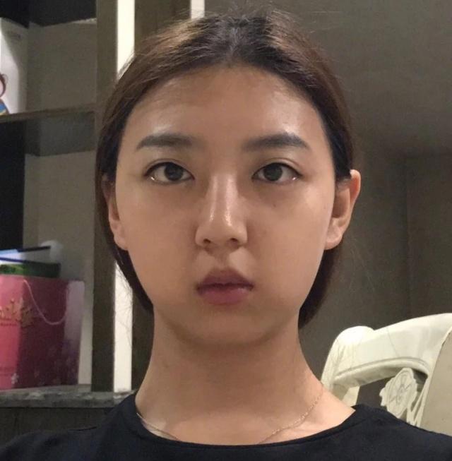 如何消除双下巴让脸型更好看,下巴松弛造成的双下巴面相