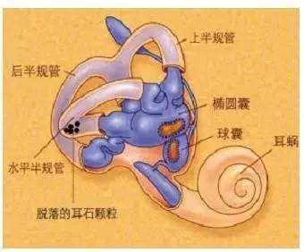 爱耳日科普系列正确认识耳鸣,爱耳日科普资料