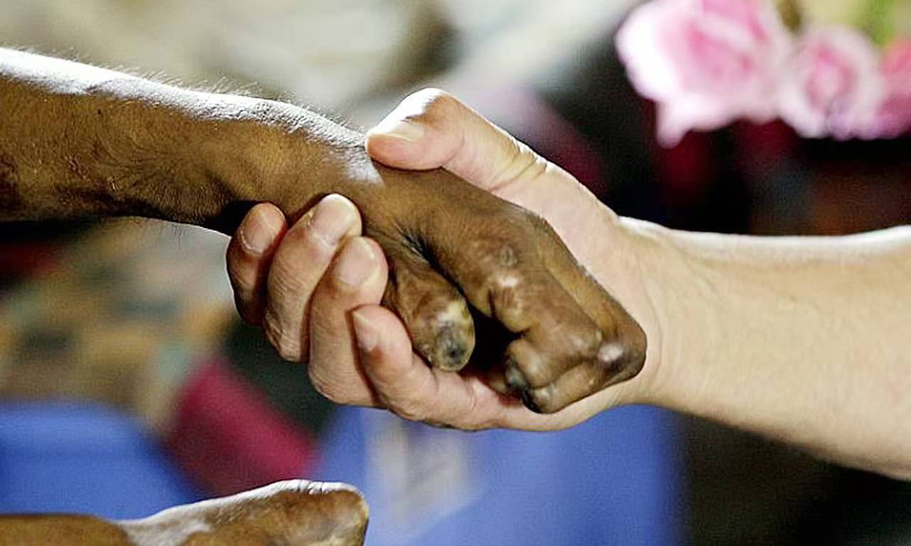 治疗麻风病最常见的药物,麻风用药