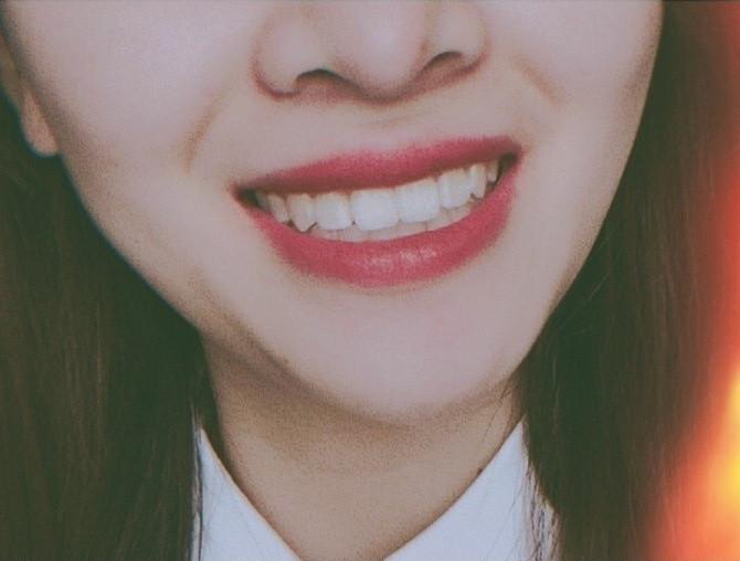 正畸日记全文阅读,我的牙套日记100字