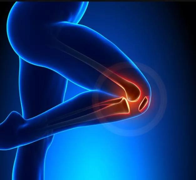 滑膜炎是关节炎吗？没那么简单