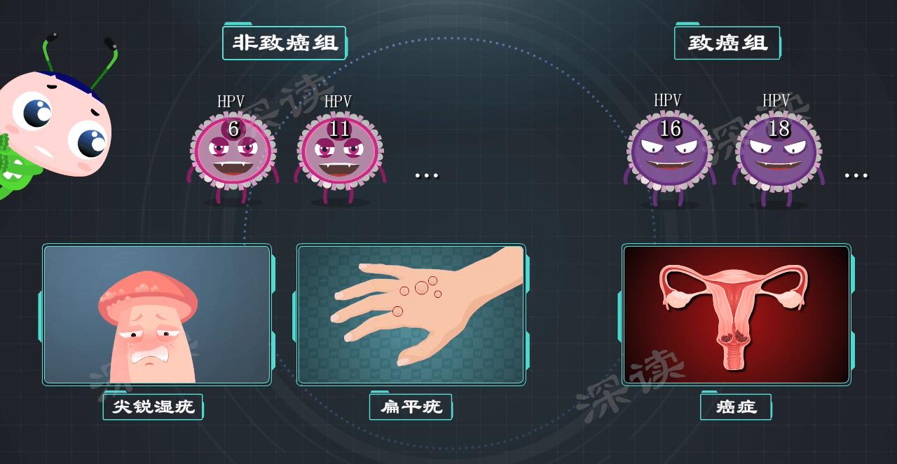 尖锐性湿疣会引起hpv感染吗,HPV感染几率有多高