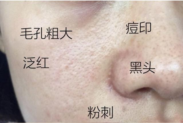 为什么很多女生化完妆会油腻？做好这两点，拥有清爽好肤感