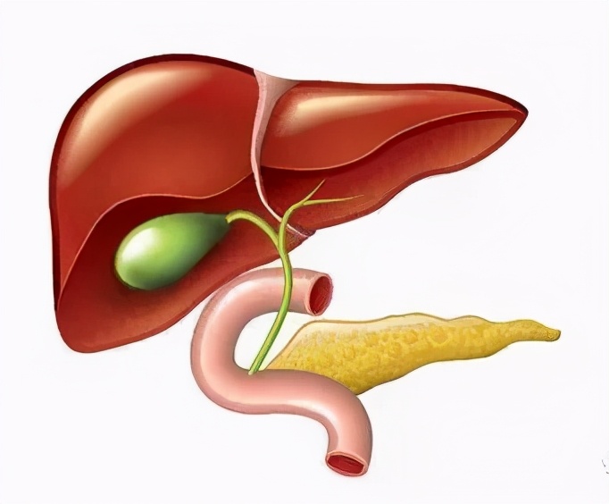 当孕妇患上了胆囊结石，怎么办？