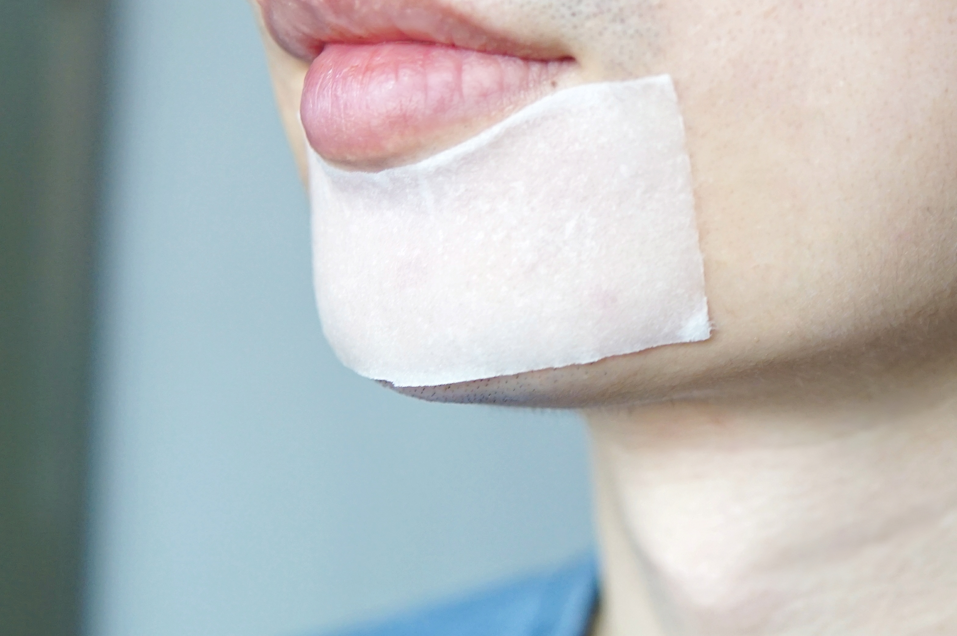 夏日科学战痘攻略,全套战痘攻略