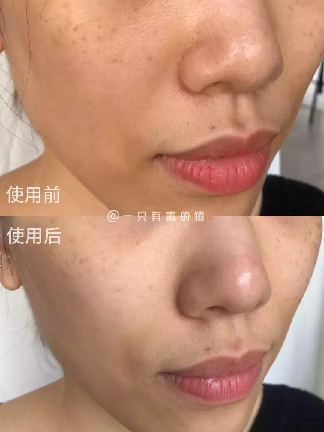 网红面膜清洁面膜,网红同款清洁面膜美白