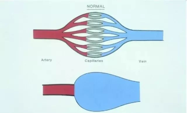 脸上红血丝不用护肤品怎么解决,脸上有红血丝用什么腮红