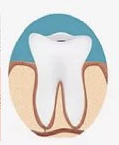 蛀牙不痛不杀神经能补牙吗,蛀牙不痛需要拔掉吗