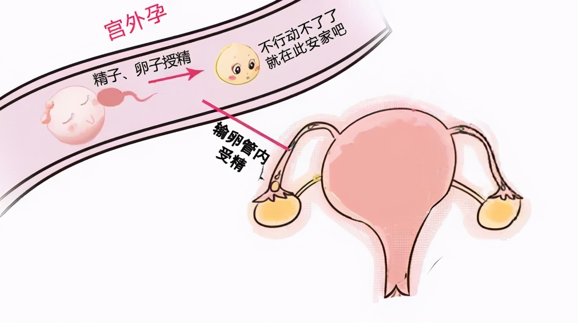 孕期出血肚子不疼正常吗,孕期出血怎么判断是不是流产