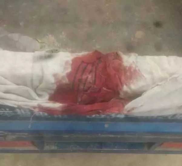 甘肃女孩被打身体出血,甘肃八岁女孩被打