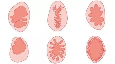3岁女孩得了阴道炎!保护好小公举,医生教你六招