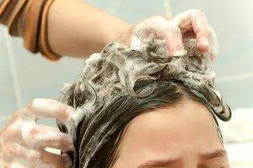 用康王洗头还有头屑怎么办,每隔一天洗头头皮痒有头屑