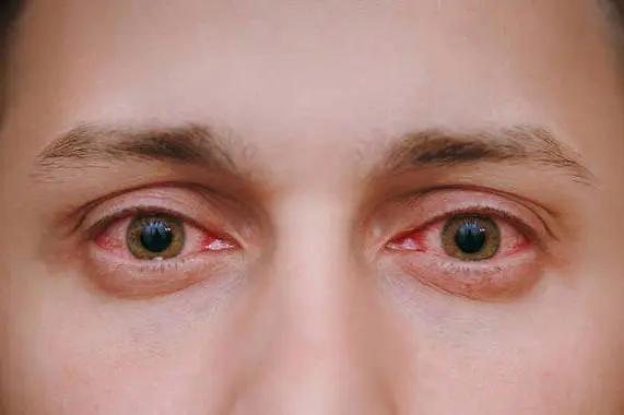 近眼距茶色墨镜,普通眼镜戴在阳光下就变墨镜