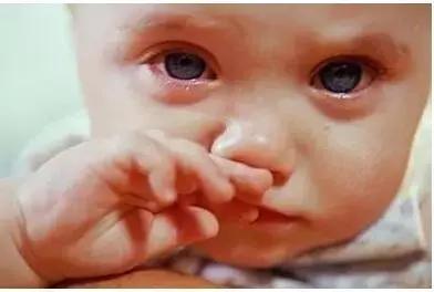 宝宝不会擤鼻子,宝宝不会擤鼻涕视频