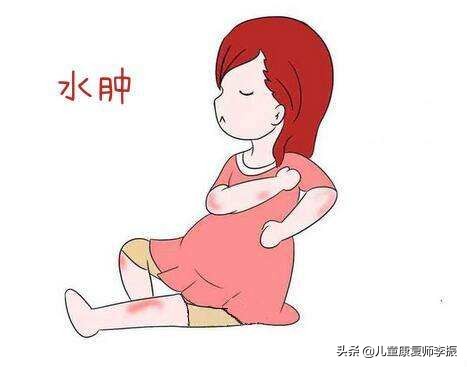 孕妈怎么缓解孕期水肿,孕期脚水肿跟喝汤喝水有关系吗