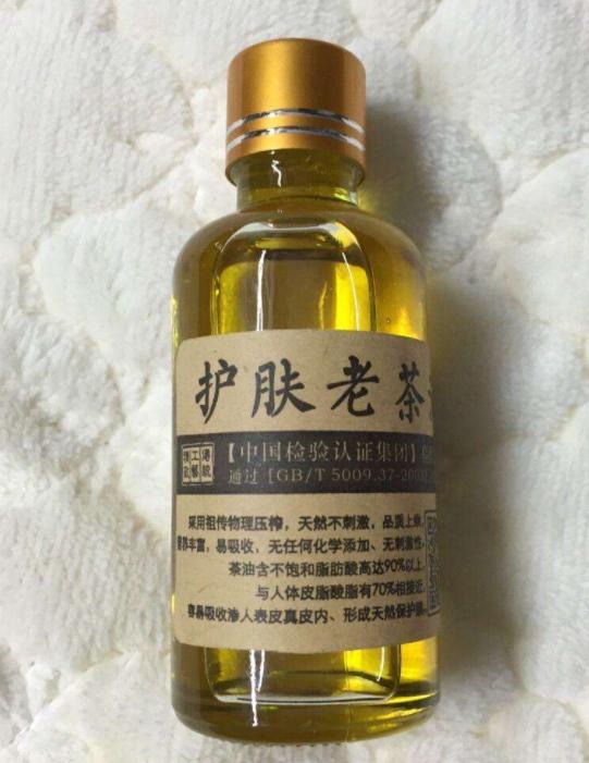 胖宝宝褶皱处红了怎么办,宝宝胖嘟嘟的脸就是好看