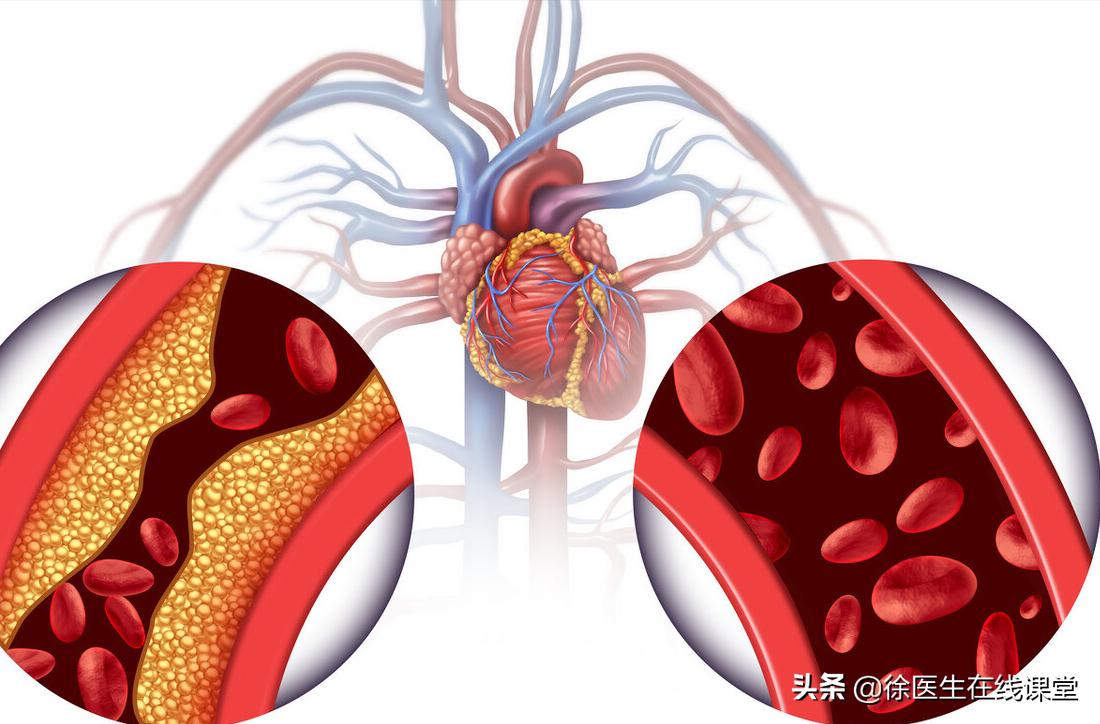 血粘度高吃药管用吗,血粘度偏高吃丹参片行吗
