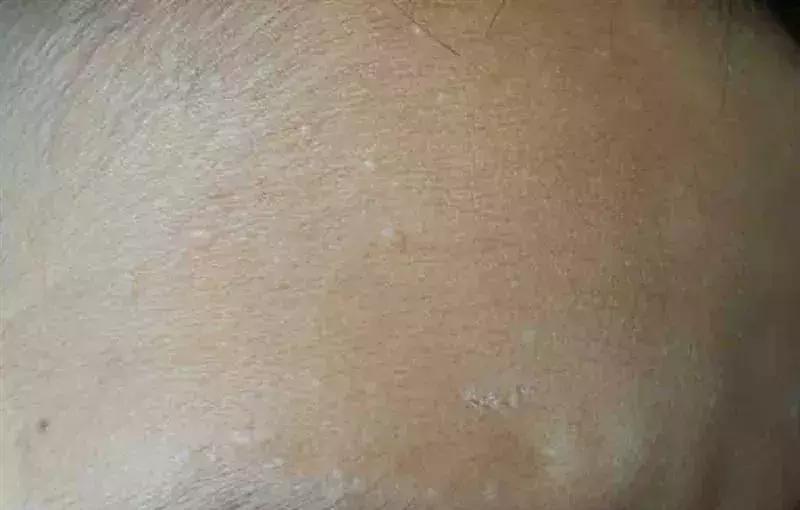 灏忕櫧涔熻兘闂溂鍏ョ殑鍖荤編椤圭洰,鍖荤編涓殑绱犻缇庤倢椤圭洰