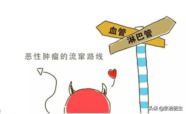 女性宫颈癌发生概率,宫颈癌淋巴结转移到肺部会怎样