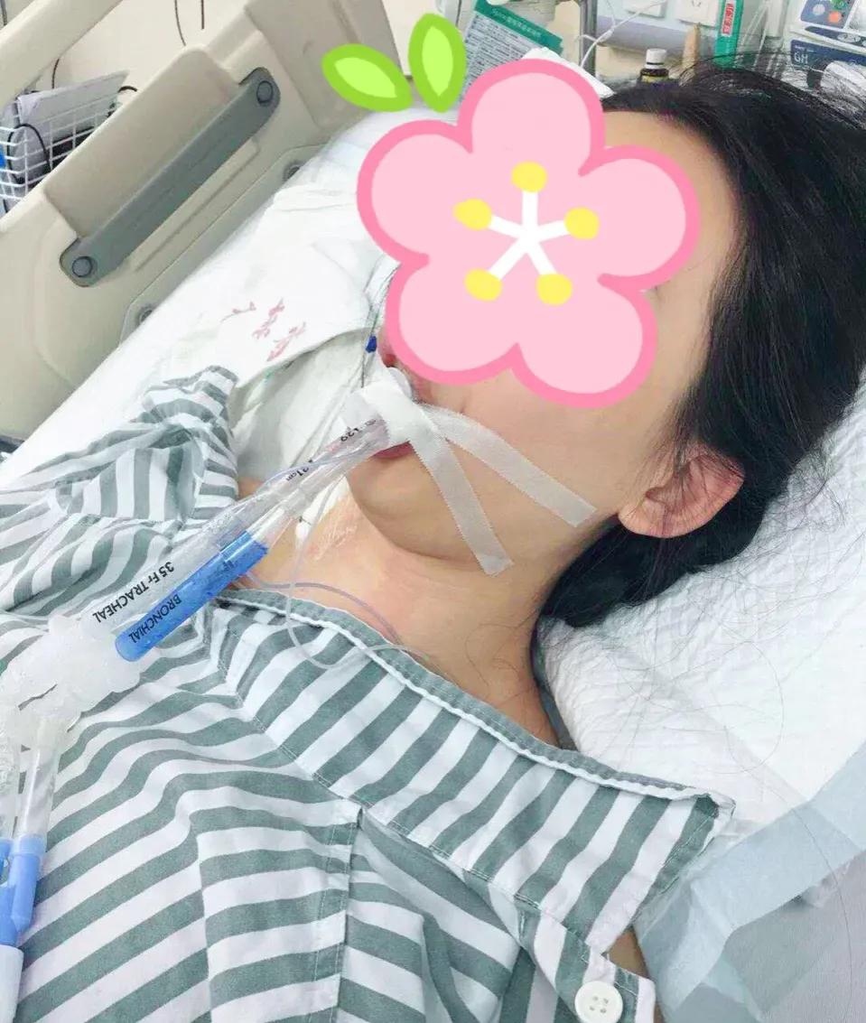 早上水肿属于什么原因,早上起来水肿多久才能消