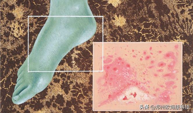 什么鞋垫防脚臭最好使,哪款鞋垫防脚臭最好