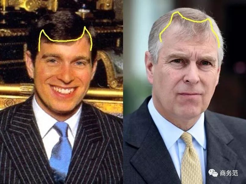 威廉王子秃顶了哈里为啥没秃顶,威廉王子为什么喜欢秃顶