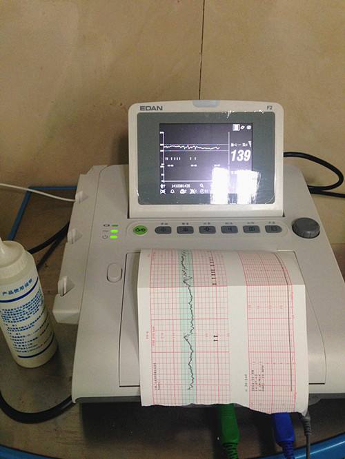胎心监护时好时坏会是慢性缺氧吗,胎心监护能确定宝宝是否缺氧吗