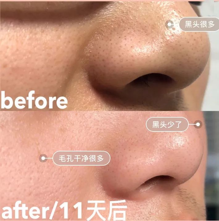 一块值得回购10000次的驴奶皂，必须买它！买它