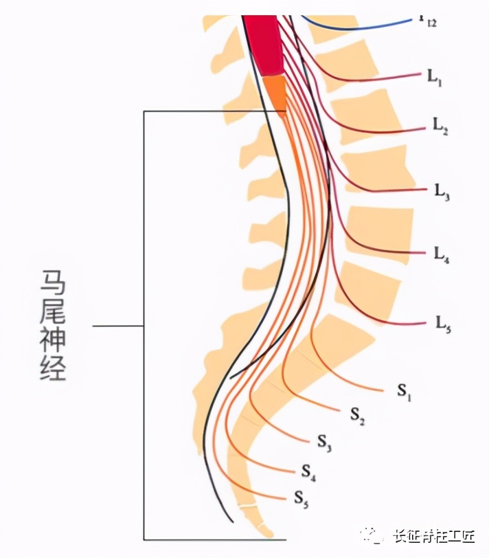 老年人腰椎管狭窄可以微创手术吗,老年人腰椎管狭窄瘫痪