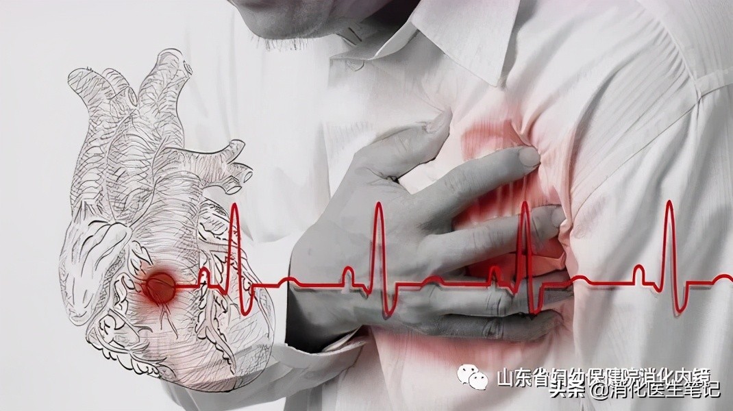 心肌梗死患者能做胃镜吗,惊了一身冷汗